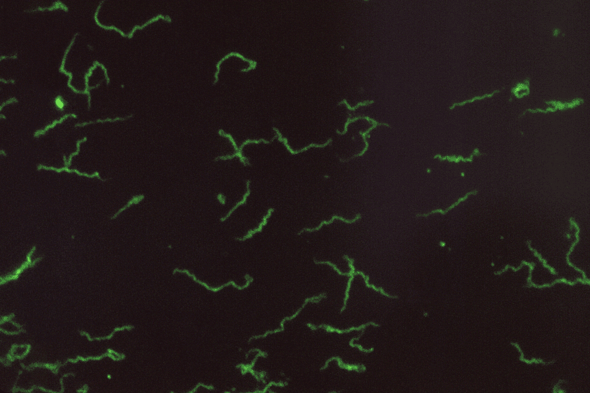 A close look at Lyme bacteria in the myelin sheath