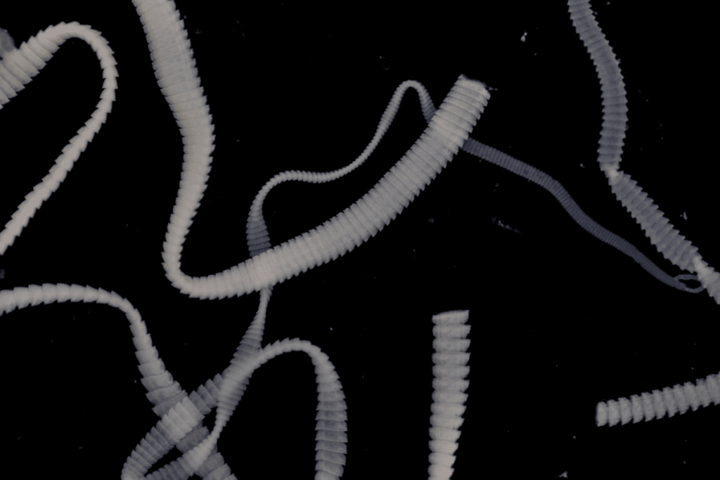 Tapeworm Infection Symptoms and Treatments Live Disease Free