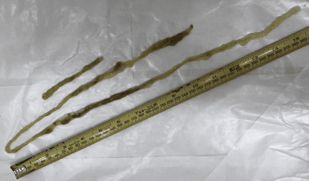 Large Roundworms in MS Live Disease Free