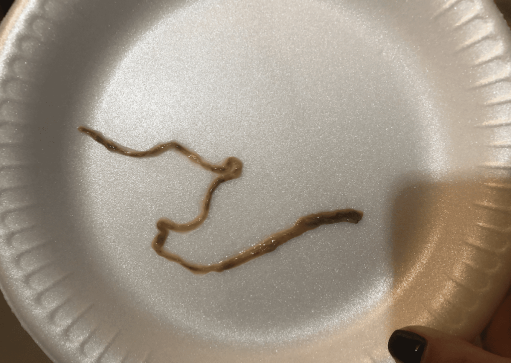 Large Roundworms in MS Live Disease Free